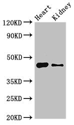 MNDA Antibody - Western Blot Positive WB detected in:Mouse heart tissue,Mouse kidney tissue All Lanes:MNDA antibody at 4µg/ml Secondary Goat polyclonal to rabbit IgG at 1/50000 dilution Predicted band size: 46 KDa Observed band size: 46 KDa