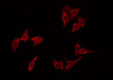 MNDA Antibody - Staining LOVO cells by IF/ICC. The samples were fixed with PFA and permeabilized in 0.1% Triton X-100, then blocked in 10% serum for 45 min at 25°C. The primary antibody was diluted at 1:200 and incubated with the sample for 1 hour at 37°C. An Alexa Fluor 594 conjugated goat anti-rabbit IgG (H+L) Ab, diluted at 1/600, was used as the secondary antibody.