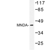 MNDA Antibody - Western blot of MNDA (V406) pAb in extracts from LOVO cells.