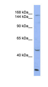 MNK / ATP7A Antibody - ATP7A antibody Western blot of HT1080 cell lysate. This image was taken for the unconjugated form of this product. Other forms have not been tested.