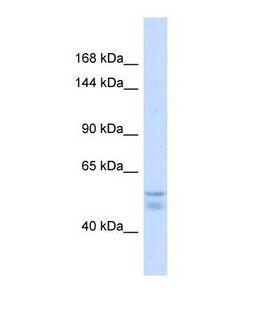 MNK / ATP7A Antibody - Western blot of Human Fetal Liver. ATP7A antibody dilution 1.0 ug/ml.  This image was taken for the unconjugated form of this product. Other forms have not been tested.