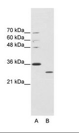 MNK / ATP7A Antibody - A: Marker, B: HepG2 Cell Lysate.  This image was taken for the unconjugated form of this product. Other forms have not been tested.