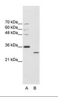 MNK / ATP7A Antibody - A: Marker, B: HepG2 Cell Lysate.  This image was taken for the unconjugated form of this product. Other forms have not been tested.