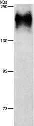 MNK / ATP7A Antibody - Western blot analysis of HepG2 cell, using ATP7A Polyclonal Antibody at dilution of 1:800.