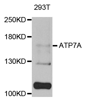 MNK / ATP7A Antibody - Western blot analysis of extracts of 293T cells.