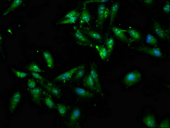 MNK / ATP7A Antibody - Immunofluorescence staining of Hela cells at a dilution of 1:100, counter-stained with DAPI. The cells were fixed in 4% formaldehyde, permeabilized using 0.2% Triton X-100 and blocked in 10% normal Goat Serum. The cells were then incubated with the antibody overnight at 4 °C.The secondary antibody was Alexa Fluor 488-congugated AffiniPure Goat Anti-Rabbit IgG (H+L) .