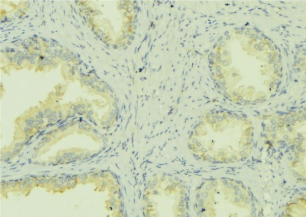 MNK / ATP7A Antibody - 1:100 staining mouse colon tissue by IHC-P. The sample was formaldehyde fixed and a heat mediated antigen retrieval step in citrate buffer was performed. The sample was then blocked and incubated with the antibody for 1.5 hours at 22°C. An HRP conjugated goat anti-rabbit antibody was used as the secondary.