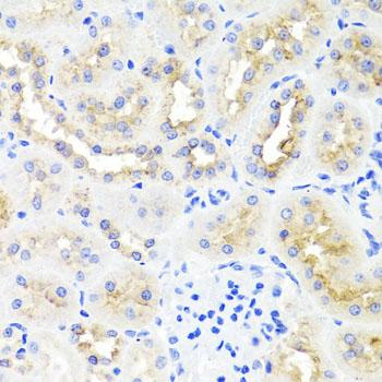 MNK / ATP7A Antibody - Immunohistochemistry of paraffin-embedded Rat kidney using ATP7A Polyclonal Antibody at dilution of 1:100 (40x lens).