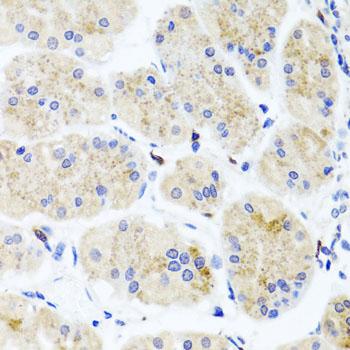 MNK / ATP7A Antibody - Immunohistochemistry of paraffin-embedded Human stomach using ATP7A Polyclonal Antibody at dilution of 1:100 (40x lens).