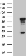 MNS1 Antibody - HEK293T cells were transfected with the pCMV6-ENTRY control. (Left lane) or pCMV6-ENTRY MNS1. (Right lane) cDNA for 48 hrs and lysed. Equivalent amounts of cell lysates. (5 ug per lane) were separated by SDS-PAGE and immunoblotted with anti-MNS1. (1:2000)