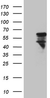 MNS1 Antibody - HEK293T cells were transfected with the pCMV6-ENTRY control. (Left lane) or pCMV6-ENTRY MNS1. (Right lane) cDNA for 48 hrs and lysed. Equivalent amounts of cell lysates. (5 ug per lane) were separated by SDS-PAGE and immunoblotted with anti-MNS1. (1:2000)