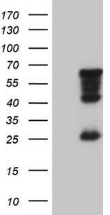 MNS1 Antibody - HEK293T cells were transfected with the pCMV6-ENTRY control. (Left lane) or pCMV6-ENTRY MNS1. (Right lane) cDNA for 48 hrs and lysed. Equivalent amounts of cell lysates. (5 ug per lane) were separated by SDS-PAGE and immunoblotted with anti-MNS1. (1:2000)