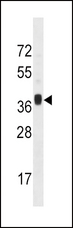 MNX1 / HB9 Antibody - MNX1 Antibody western blot of mouse liver tissue lysates (35 ug/lane). The MNX1 antibody detected the MNX1 protein (arrow).
