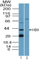 MNX1 / HB9 Antibody - Western blot of HB9 in MOLT-4 cell lysates in the 1) absence and 2) presence of immunizing peptide using Polyclonal Antibody to HB9 at 0.5 ug/ml. Goat anti-rabbit Ig HRP secondary antibody, and PicoTect ECL substrate solution, were used for this test.