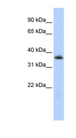 MNX1 / HB9 Antibody - MNX1 / HB9 antibody Western blot of HepG2 cell lysate. This image was taken for the unconjugated form of this product. Other forms have not been tested.