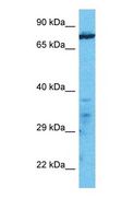 MOAP1 / MAP1 Antibody - Western blot of MOAP1 Antibody with human Jurkat Whole Cell lysate.  This image was taken for the unconjugated form of this product. Other forms have not been tested.