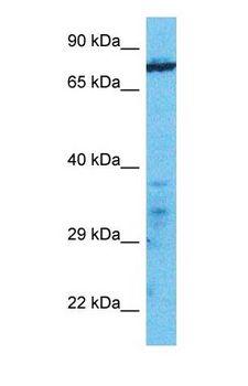MOAP1 / MAP1 Antibody - Western blot of MOAP1 Antibody with human Jurkat Whole Cell lysate.  This image was taken for the unconjugated form of this product. Other forms have not been tested.