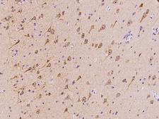 MOAP1 / MAP1 Antibody - Immunochemical staining of human MOAP1 in human brain with rabbit polyclonal antibody at 1:100 dilution, formalin-fixed paraffin embedded sections.