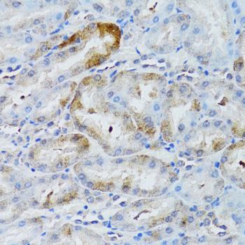 MOAP1 / MAP1 Antibody - Immunohistochemistry of paraffin-embedded Rat kidney using MOAP1 Polyclonal Antibody at dilution of 1:100 (40x lens).