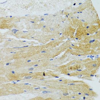 MOAP1 / MAP1 Antibody - Immunohistochemistry of paraffin-embedded Rat heart using MOAP1 Polyclonal Antibody at dilution of 1:100 (40x lens).