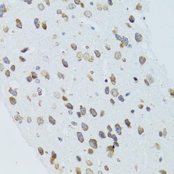 MOAP1 / MAP1 Antibody - Immunohistochemistry of paraffin-embedded Mouse brain using MOAP1 Polyclonal Antibody at dilution of 1:100 (40x lens).