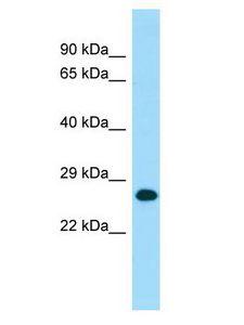 MOB1A Antibody - MOB1A antibody Western Blot of Human fetal heart. Antibody dilution: 1 ug/ml.  This image was taken for the unconjugated form of this product. Other forms have not been tested.