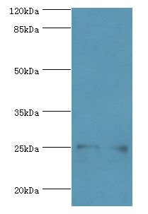 MOB1A Antibody - Western blot. All lanes: MOB kinase activator 1A antibody at 2 ug/ml Lane 1:Jurkat whole cell lysate. Lane 2: mouse small intestine tissue. Secondary antibody: Goat polyclonal to rabbit at 1:10000 dilution. Predicted band size: 25 kDa. Observed band size: 25 kDa.  This image was taken for the unconjugated form of this product. Other forms have not been tested.