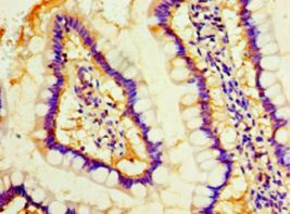 MOB1A Antibody - Immunohistochemistry of paraffin-embedded human small intestine tissue using antibody at 1:100 dilution.  This image was taken for the unconjugated form of this product. Other forms have not been tested.
