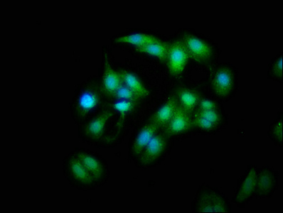 MOB1A Antibody - Immunofluorescence staining of HepG2 cells with MOB1A Antibody at 1:333, counter-stained with DAPI. The cells were fixed in 4% formaldehyde, permeabilized using 0.2% Triton X-100 and blocked in 10% normal Goat Serum. The cells were then incubated with the antibody overnight at 4°C. The secondary antibody was Alexa Fluor 488-congugated AffiniPure Goat Anti-Rabbit IgG(H+L).