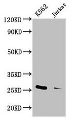 MOB1A Antibody - Western Blot Positive WB detected in: K562 whole cell lysate, Jurkat whole cell lysate All lanes: MOB1A antibody at 3.3µg/ml Secondary Goat polyclonal to rabbit IgG at 1/50000 dilution Predicted band size: 26 kDa Observed band size: 26 kDa