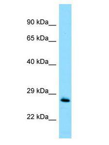 MOB1A Antibody - MOB1A antibody Western Blot of Jurkat. Antibody dilution: 1 ug/ml.  This image was taken for the unconjugated form of this product. Other forms have not been tested.