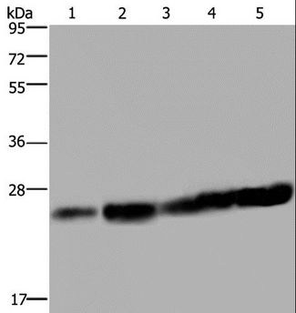 MOB1A Antibody - Western blot analysis of HeLa and Jurkat cell, mouse liver tissue, K562 and A375 cell, using MOB1A Polyclonal Antibody at dilution of 1:200.