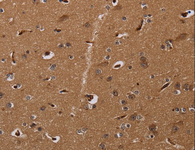 MOB1A Antibody - Immunohistochemistry of paraffin-embedded Human brain using MOB1A Polyclonal Antibody at dilution of 1:30.