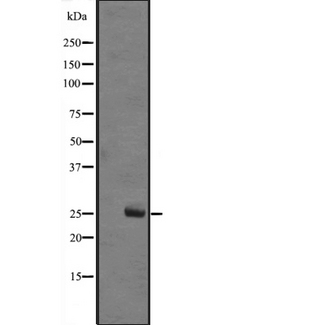 MOB1A Antibody - Western blot analysis of MOBKL1B expression in A431 whole cells lysate. The lane on the left is treated with the antigen-specific peptide.