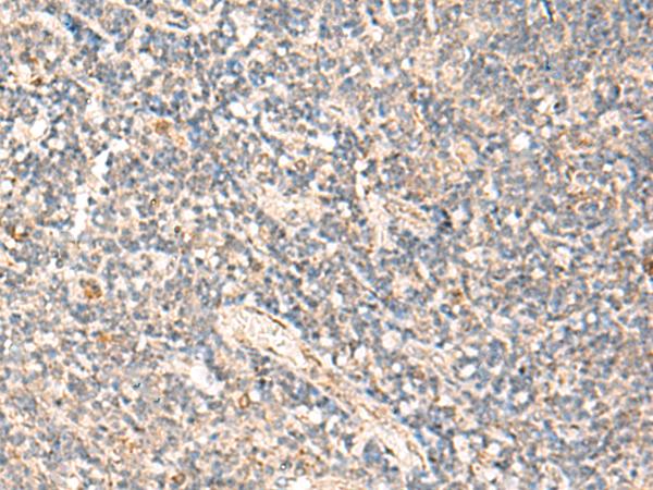 MOB1A Antibody - Immunohistochemistry of paraffin-embedded Human tonsil tissue  using MOB1A Polyclonal Antibody at dilution of 1:50(×200)