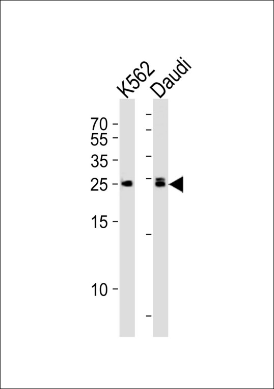MOB1B / MOBKL1A Antibody - Western blot of lysates from K562, Daudi cell line (from left to right), using MOB4A Antibody. Antibody was diluted at 1:1000 at each lane. A goat anti-rabbit IgG H&L (HRP) at 1:5000 dilution was used as the secondary antibody. Lysates at 35ug per lane.