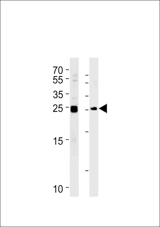 MOB1B / MOBKL1A Antibody - MOB4A Antibody western blot of Daudi,K562 cell line lysates (35 ug/lane). The MOB4A antibody detected the MOB4A protein (arrow).