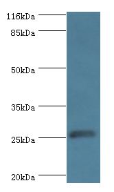 MOB1B / MOBKL1A Antibody - Western blot. All lanes: MOB kinase activator 1B antibody at 2 ug/ml+Jurkat whole cell lysate. Secondary antibody: Goat polyclonal to rabbit at 1:10000 dilution. Predicted band size: 25 kDa. Observed band size: 25 kDa.  This image was taken for the unconjugated form of this product. Other forms have not been tested.