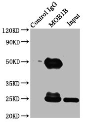MOB1B / MOBKL1A Antibody - Immunoprecipitating MOB1B in K562 whole cell lysate Lane 1: Rabbit control IgG (1µg) instead of MOB1B Antibody in K562 whole cell lysate.For western blotting, a HRP-conjugated Protein G antibody was used as the secondary antibody (1/2000) Lane 2: MOB1B Antibody (6µg) + K562 whole cell lysate (500µg) Lane 3: K562 whole cell lysate (10µg)