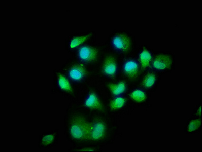 MOB1B / MOBKL1A Antibody