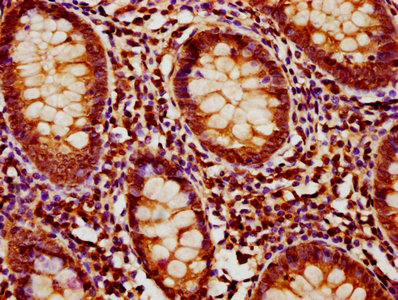 MOB1B / MOBKL1A Antibody - IHC image of MOB1B Antibody diluted at 1:1200 and staining in paraffin-embedded human appendix tissue performed on a Leica BondTM system. After dewaxing and hydration, antigen retrieval was mediated by high pressure in a citrate buffer (pH 6.0). Section was blocked with 10% normal goat serum 30min at RT. Then primary antibody (1% BSA) was incubated at 4°C overnight. The primary is detected by a biotinylated secondary antibody and visualized using an HRP conjugated SP system.