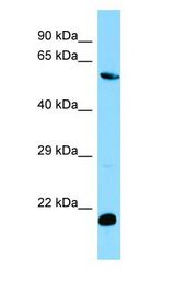 MOB1B / MOBKL1A Antibody - MOB1B / MOBKL1A antibody Western Blot of Jurkat.  This image was taken for the unconjugated form of this product. Other forms have not been tested.