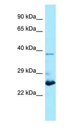 MOB1B / MOBKL1A Antibody - MOB1B / MOBKL1A antibody Western Blot of Jurkat cell lysate.  This image was taken for the unconjugated form of this product. Other forms have not been tested.