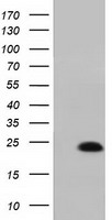 MOB1B / MOBKL1A Antibody - HEK293T cells were transfected with the pCMV6-ENTRY control (Left lane) or pCMV6-ENTRY MOBKL1A (Right lane) cDNA for 48 hrs and lysed. Equivalent amounts of cell lysates (5 ug per lane) were separated by SDS-PAGE and immunoblotted with anti-MOBKL1A.