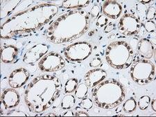 MOB1B / MOBKL1A Antibody - Immunohistochemical staining of paraffin-embedded Human Kidney tissue using anti-MOBKL1A mouse monoclonal antibody. (Dilution 1:50).