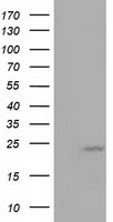 MOB1B / MOBKL1A Antibody - HEK293T cells were transfected with the pCMV6-ENTRY control (Left lane) or pCMV6-ENTRY MOBKL1A (Right lane) cDNA for 48 hrs and lysed. Equivalent amounts of cell lysates (5 ug per lane) were separated by SDS-PAGE and immunoblotted with anti-MOBKL1A.
