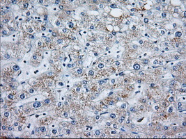 MOB1B / MOBKL1A Antibody - Immunohistochemical staining of paraffin-embedded Human liver tissue using anti-MOBKL1A mouse monoclonal antibody. (Dilution 1:50).