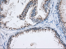 MOB1B / MOBKL1A Antibody - Immunohistochemical staining of paraffin-embedded Human prostate tissue using anti-MOBKL1A mouse monoclonal antibody. (Dilution 1:50).