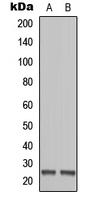 MOB1B / MOBKL1A Antibody - Western blot analysis of MOB1B expression in Ramos (A); HEK293T (B) whole cell lysates.