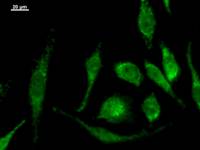 MOB2 Antibody - Immunostaining analysis in HeLa cells. HeLa cells were fixed with 4% paraformaldehyde and permeabilized with 0.1% Triton X-100 in PBS. The cells were immunostained with anti-HCCA2 mAb.